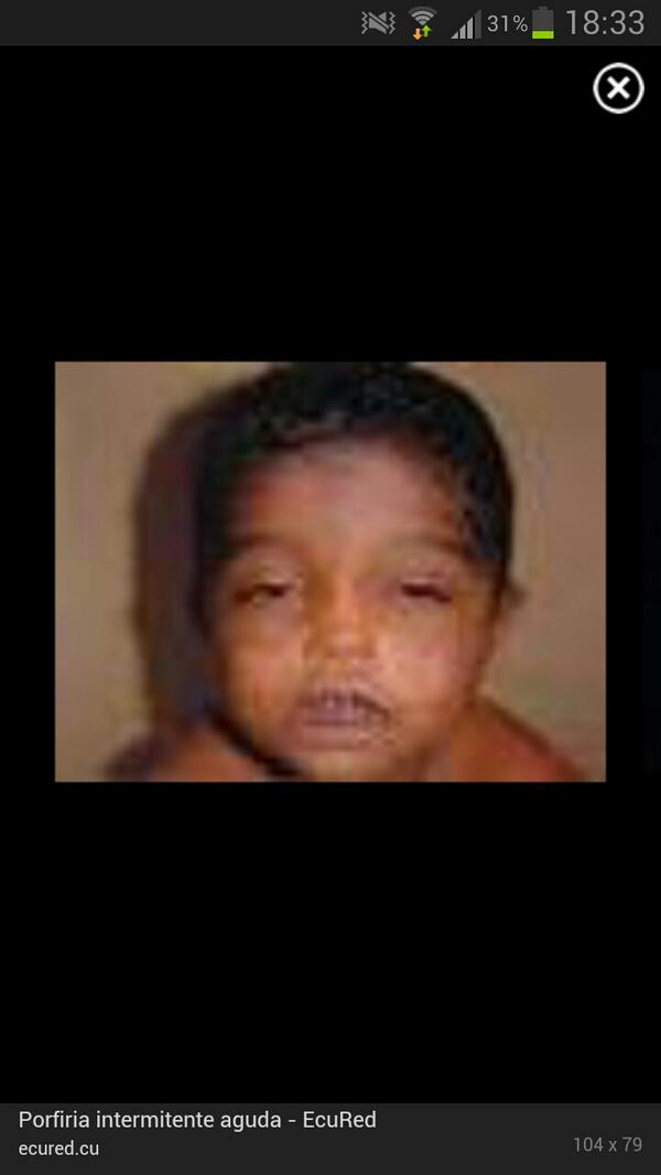 RafaSoler97's tweet image. @NataliaAriza98 mirate después de tomar el sol x) #SaveNAT*