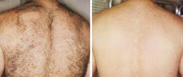 stellamercer's tweet photo. Menacing problem of unwanted hair has a remedy!
  http://t.co/0NDKGY20Wy http://t.co/AOtWPXDv15