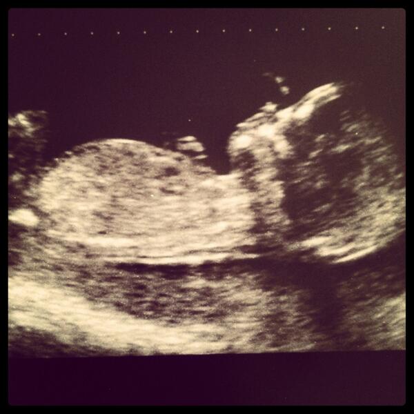 domrizzo23's tweet photo. #mybaby #14weeks #cutie http://t.co/LSdTXyuqhI