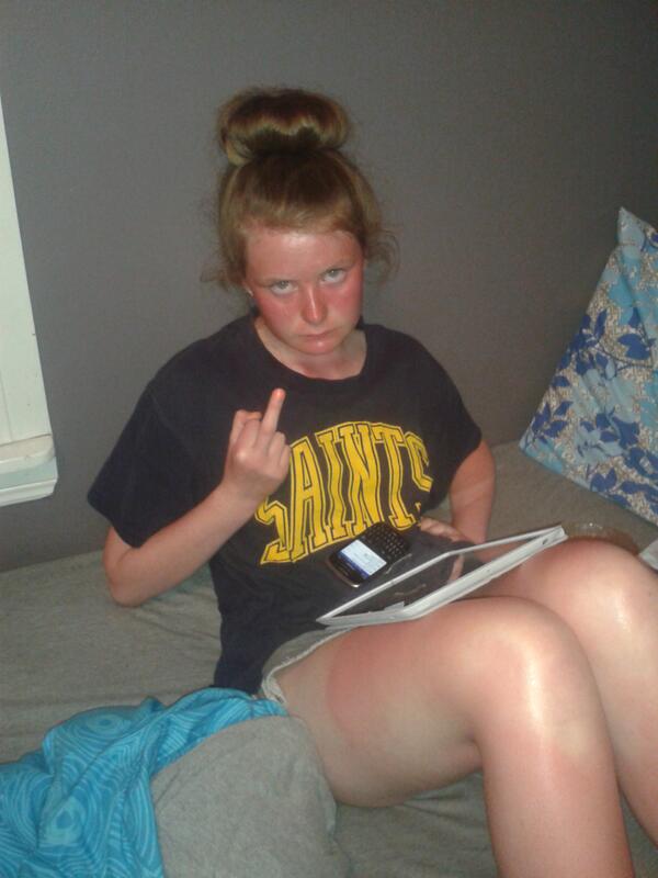 RitaOG93's tweet photo. cheer up @angiepants_ youre only a tid bit sunburnt #gingerproblems #irishgirlproblems -#gallonsofaloe http://t.co/R8HBlahY16