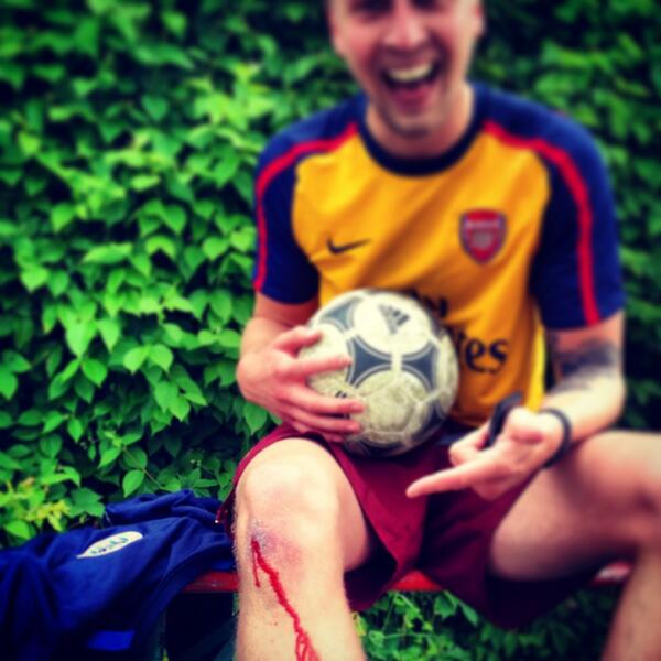 PPRFC's tweet image. It'd only just healed too! @CarstenTomkins @andrewmeddings @DickieDes @jamesflynn87  #PPRTraining #SlideTackleDrills