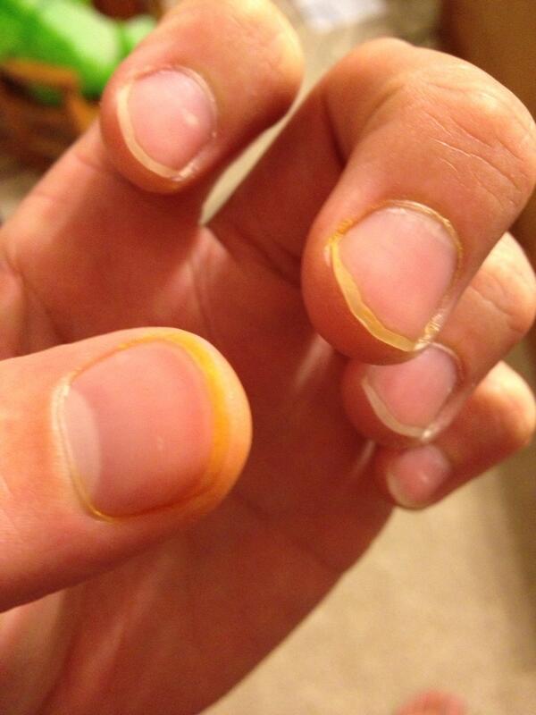 saslates's tweet image. #lifeguardprobs #pHindicator #orangefingers