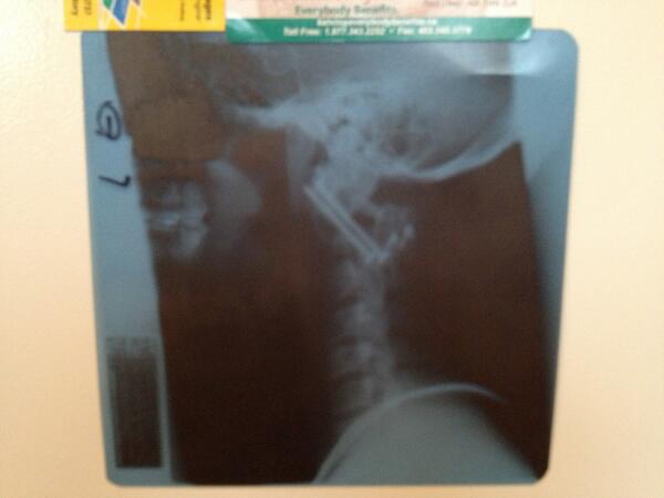 Trent Aylward tweet media