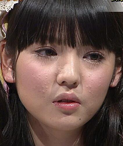 芸能人のすっぴん メイク術 道重さゆみちゃんのすっぴん 肌荒れがひどいみたい Http T Co I4y7qhotej