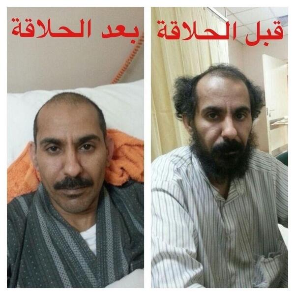 meelo_0's tweet photo. حصل له حادث من4شهور ونقل لمستشفى الإيمان بالرياض
صحته جيدة فقد الذاكرة يبحث عن أهله ساعدونا

@7kmkw 

#رتويت http://t.co/JRFxER2Ymf"