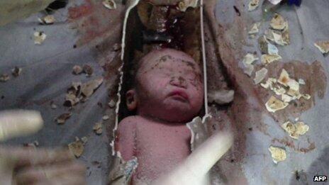 Baby rescued from sewage pipe in China bbc.in/130tgI5 WARNING: viewers may find photo disturbing