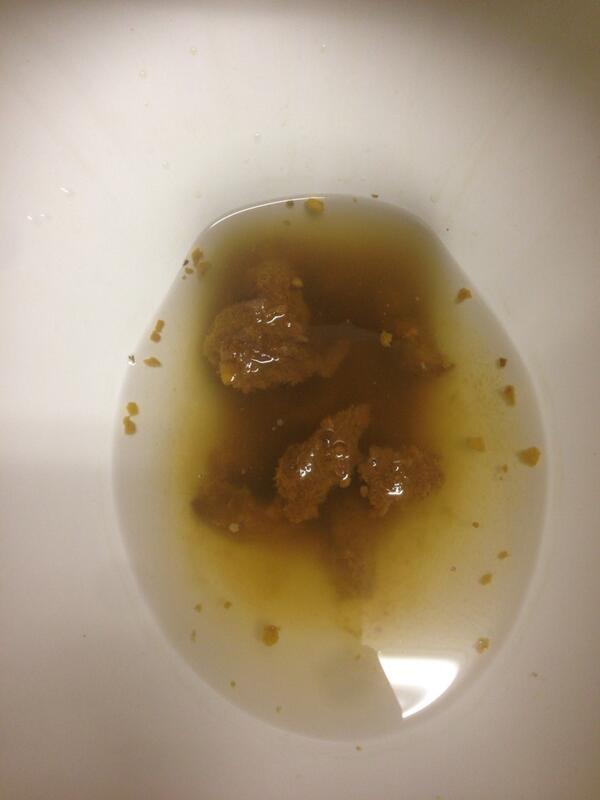 Candida Stool