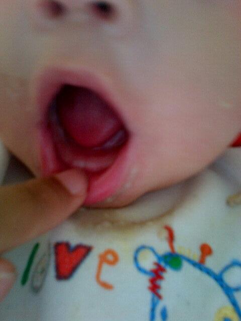 siandoyle12's tweet image. #biggirl #firstteeth #soproud