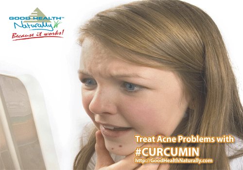 CurcuminHealth's tweet image. #Curcumin helps in treating acne problems goodhealthnaturally.com/products/Curcu…