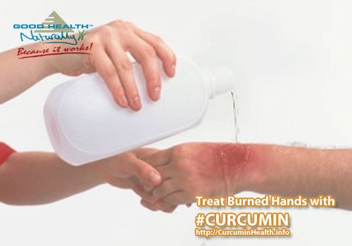 CurcuminHealth's tweet image. #Curcumin helps in treating skin burns goodhealthnaturally.com/products/Curcu…