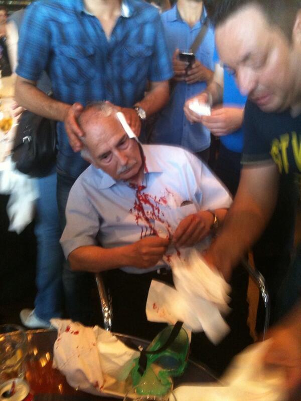 Polis, kulağı kopan bu amca için gelen ambulansın geçişine izin vermedi:  via <a href="/cancoskun/">Can Coşkun</a> #DirenGeziParki