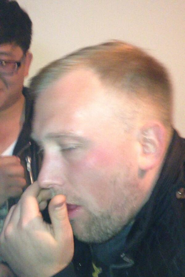 @LongLiveLewbo why the random attack lewbo spesh when you are actually rapidly receding x