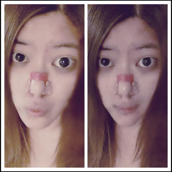 dadatoom's tweet photo. ที่หนีบจมูกเกาหลีเพิ่มความโด่ง http://t.co/37P4V6ytSb