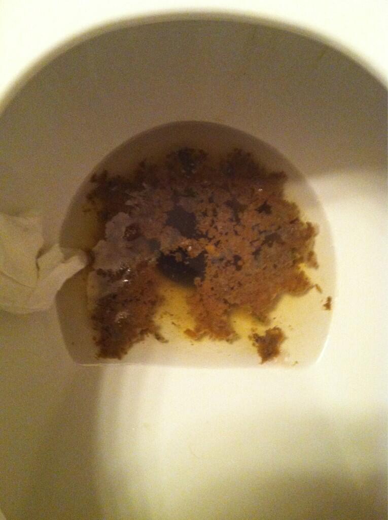 poop on poops Everyone does it and many have developed a set of rituals and beliefs, some false, about the act of clearing one's bowels you might think that you know your stuff about poop, but misconceptions. poop on poops Everyone does it and many have developed a set of rituals and beliefs, some false, about the act of clearing one's bowels you might think that you know your stuff about poop, but misconceptions.