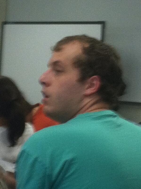 Receding hairline age