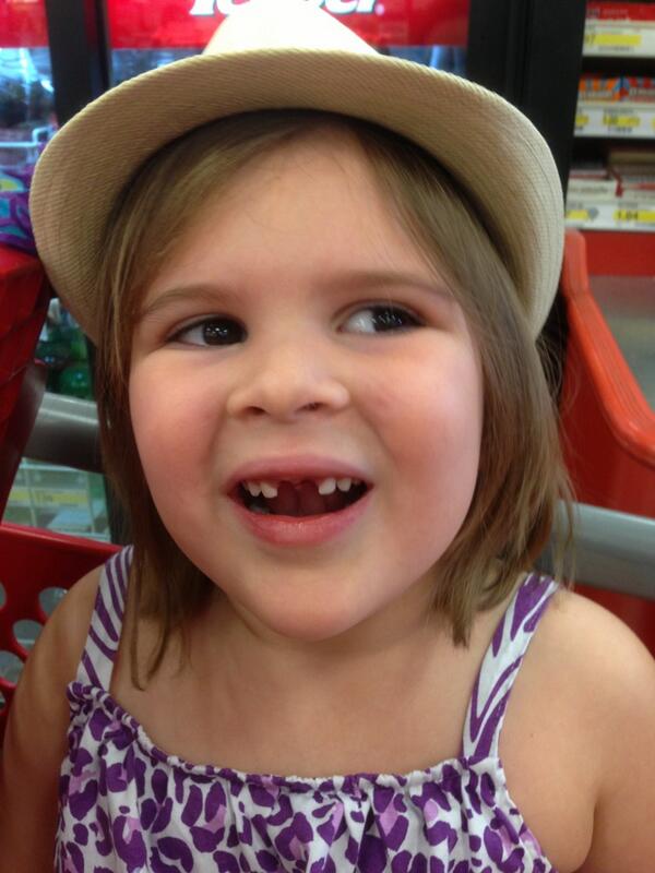 corie_core's tweet image. Surgery went well #2frontteeth