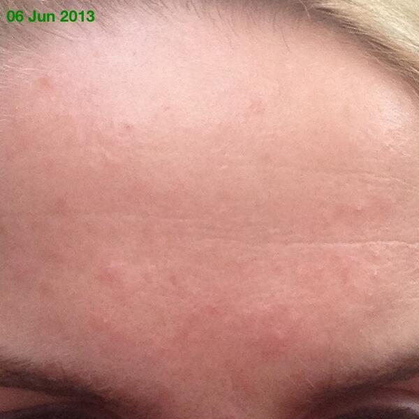 WrinkleMonitor's tweet image. 