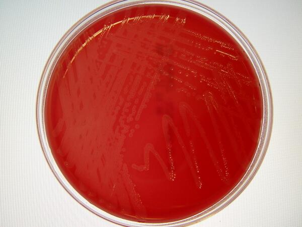 Moraxella catarrhalis микробиология. сахарно кровяной агар цейсслера состав. кровяные питательные среды. Listeria monocуtogenes (листерии). кровяные питательные среды.