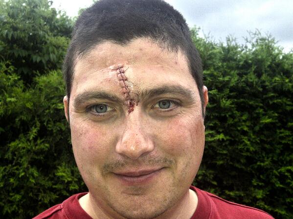 Tough day on the pitch for the Highlanders last weekend. Looking to regroup vs <a href="/DingoRugby/">Dingos RFC</a> Hopefully no more of this.