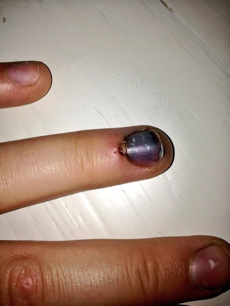 fremsætte Den aktuelle resultat cassandra guldhammer on Twitter: "@kidrauhlssexay my finger  http://t.co/x1dUwMgWxc" / Twitter