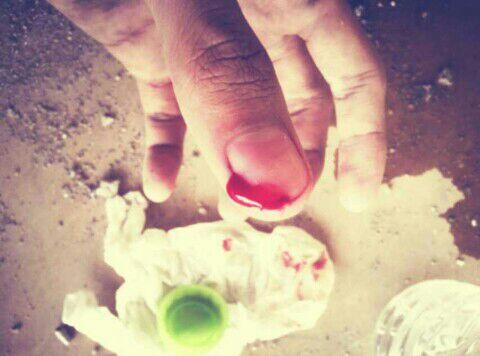 DeviloStylo's tweet image. #kuliBangunan sangat Akrab Dengan Luka !!! #wtf .