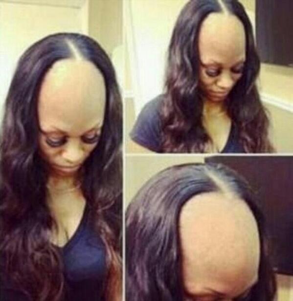 Forehead