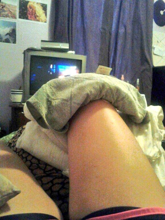 ingeuine's tweet image. well I had surgery on my knee so