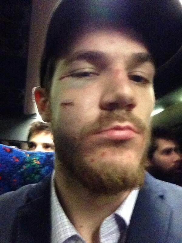 shawz15er's tweet photo. The face of a champ! http://t.co/tn1Al1mf9R