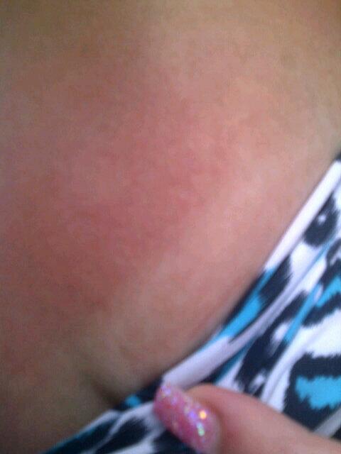 Charleyy_Miller's tweet image. 1 day in the sun yayyy #6moretogo