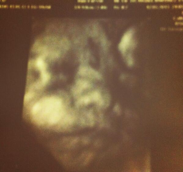 Saruxpi's tweet photo. Va a ser tan bonita como su madre... http://t.co/5u3EFtcLCI