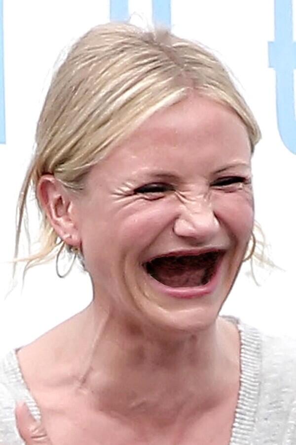 Celebs Without Teeth. 