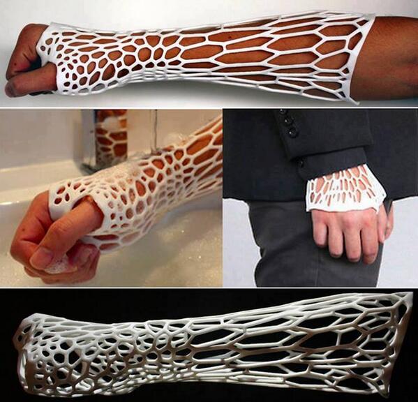 projectM3D's tweet image. CORTEX - The future of medical orthopedic cast. 3D-Printed Cast To Help Repair Broken Bones.