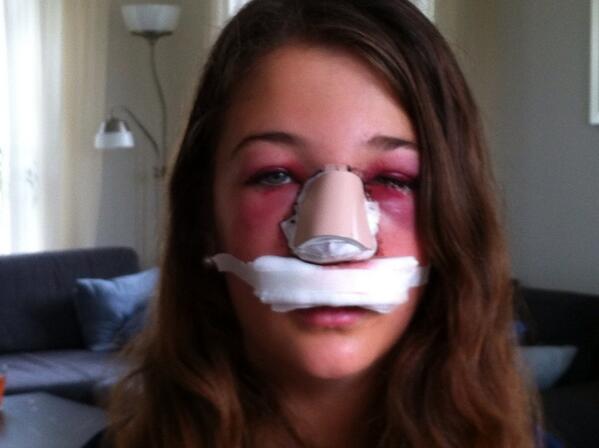 Wie kent de flessengooier? De vader van Sanne looft via #facebook 2500 euro uit. #hvnl