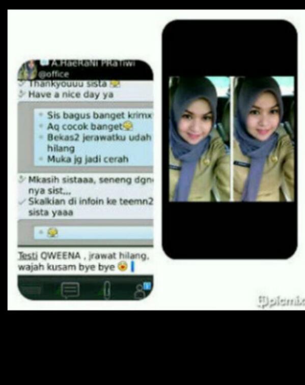 SkinCareQweena's tweet photo. Jerawat hilang wajah kusam bye.. hihihi http://t.co/MPJVI490LB