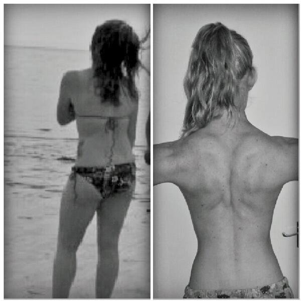 jencmelv's tweet image. Left is me about 10-12lbs from my heaviest, right is me last week. #progress #picslip #backslip