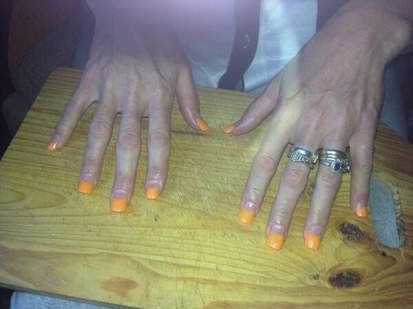 beckymyles4's tweet image. Just done my mums nails.. #orangetips