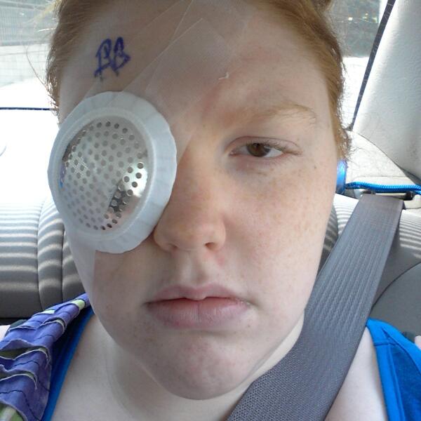momoleann's tweet image. Surgery 1 of 2. #sore #Piratepatch #eyesurgery