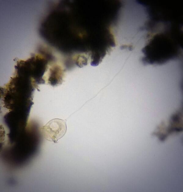FearOfTheDark's tweet image. Also, a vorticella for your viewing pleasure. #fuckyeahscience