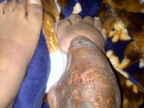 cxrxx's tweet photo. إلرجاء دعمي بالرتويت لاجد  من يتكفل بعلاجي ب المانيا http://t.co/qiBuwZ0mRS