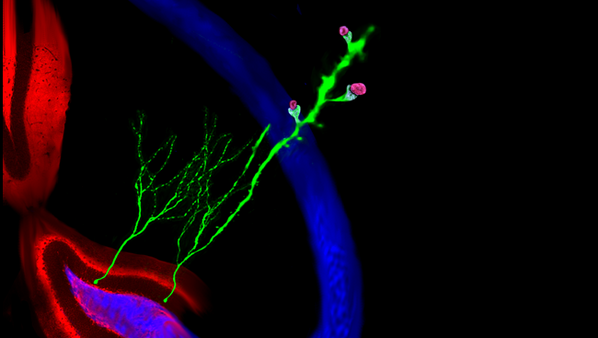 Brain_Facts_org's tweet photo. How do new neurons grow and reconnect in an injured #brain? Find out in the Image of the Week: http://t.co/rFZdfrP923 http://t.co/HocjcZiro6