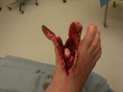 KomandoLeon's tweet photo. Auch! http://t.co/q8IbsEq9qG