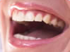 MedicurSL's tweet photo. Ven a medicur y presume de sonrisa!!! LIMPIEZA + BLANQUEAMIENTO por tan sólo 69€!!!! http://t.co/JaG4DPEVVW