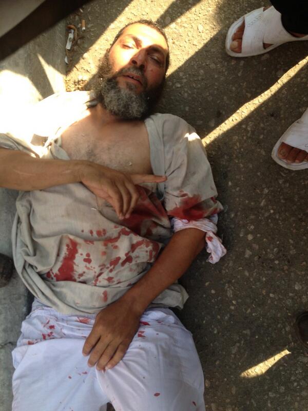 sharifkouddous's tweet photo. Wounded pro-Morsi protester says the 'shahada' http://t.co/EJc6Lmbf6r