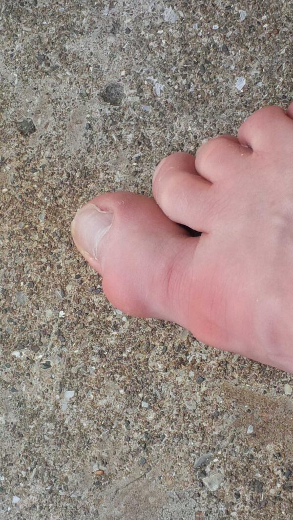 Johna_Ox's tweet photo. Think I broke me big toe.. #ouch http://t.co/PmAF3jiALw