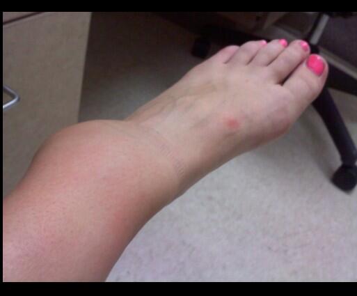 brookelancee's tweet photo. #WhyIHateMySport http://t.co/QDVUZTeO9j
