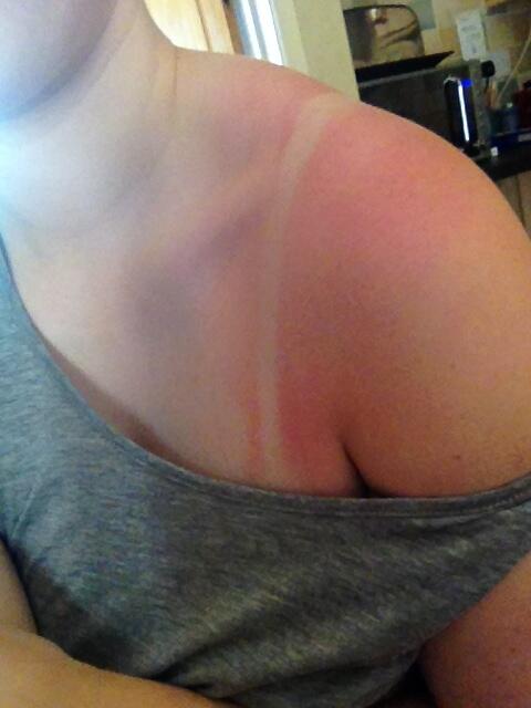 megan_scales's tweet image. So I plaster myself in sun cream and yet I still burn. There no such thing as an even tan for me ever #megproblems