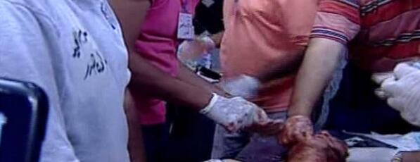 Embedded image permalink