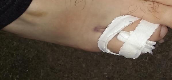 Nozza2010's tweet image. My toe is officially broken..ah screw it, I don't do things the easy way, let's have this marathon in eleven days :-)