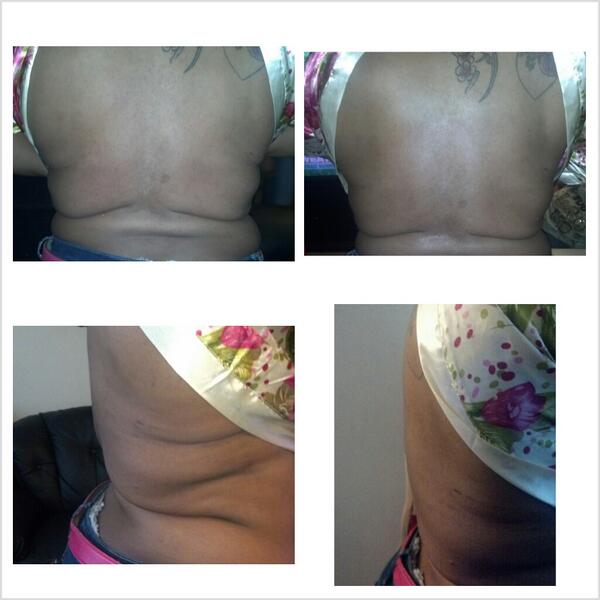 Healthy_wraps's tweet photo. No more #fat losing weight with my body wraps! Email monybanks@gmail.com to book an appt and get your sexy back http://t.co/6HVG9YaaMl