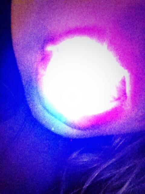 BBiszantz's tweet photo. Retweet if u wish there were light up braces!?!?!?!? http://t.co/gDyhXxUQsC